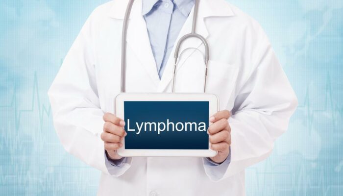 5 major types of Hodgkin&#8217;s lymphoma