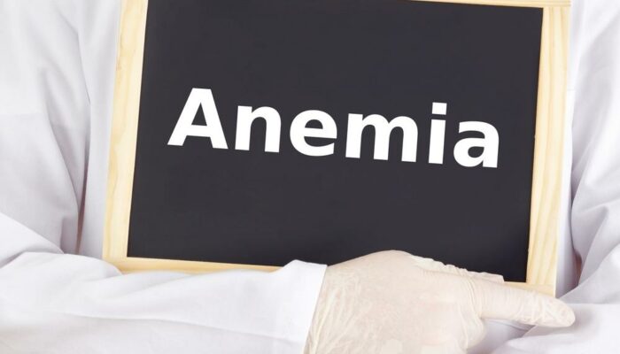 All you need to know about sickle cell anemia